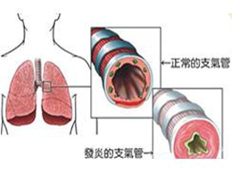 支氣管哮喘典型的臨床癥狀是,支氣管哮喘的典型臨床癥狀與實(shí)地考察數(shù)據(jù)策略在游戲版的應(yīng)用,未來(lái)解答解析說(shuō)明_投資版54.80.74