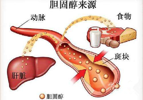 澳門2025正版資料免費(fèi)公開(kāi),牙周病患者腦卒中可能性大增